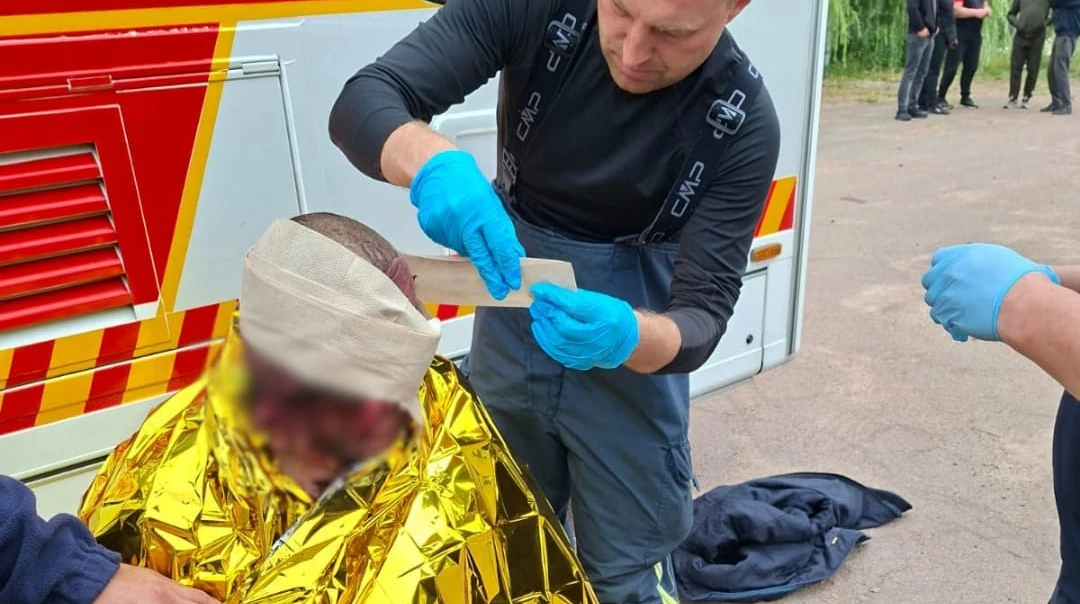 Лікарі надають першу медичну допомогу постраждалому внаслідок російської атаки на агропідприємство у Житомирській області, 30